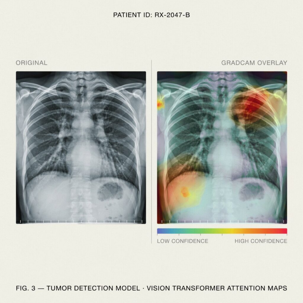 Case Study 1 — AIRIS-TB Population-Scale Tuberculosis Screening via AI